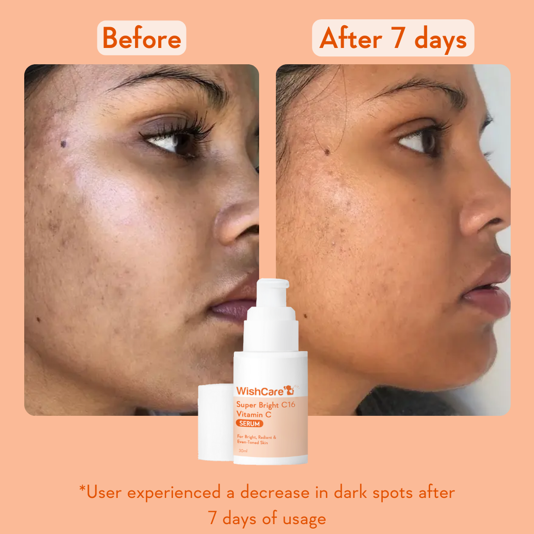 WISH CARE SUPER BRIGHT C16 VITAMIN C SERUM 30ML — photo 2