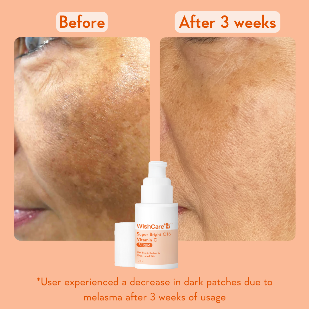 WISH CARE SUPER BRIGHT C16 VITAMIN C SERUM 30ML — photo 4